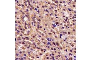 Immunohistochemical analysis of TGase5 staining in rat kidney formalin fixed paraffin embedded tissue section. (Transglutaminase 5 抗体)