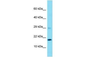 Host: Rabbit  Target Name: Rps23  Sample Tissue: Rat Liver lysates  Antibody Dilution: 1. (RPS23 抗体  (N-Term))