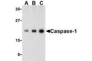 Western blot analysis of Caspase-1 in human heart cell lysate with AP30187PU-N Caspase-1 antibody at (A) 0. (Caspase 1 抗体  (C-Term))