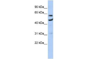 WB Suggested Anti-CNOT6 Antibody Titration:  0. (CNOT6 抗体  (N-Term))