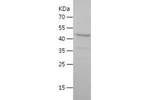 FUT8 Protein (AA 31-256) (His-IF2DI Tag)