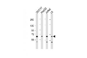 All lanes : Anti-PDP1 Antibody (Center) at 1:2000 dilution Lane 1: 293T/17 whole cell lysate Lane 2: HepG2 whole cell lysate Lane 3: Jurkat whole cell lysate Lane 4: L6 whole cell lysate Lysates/proteins at 20 μg per lane. (PDP 抗体  (AA 308-336))