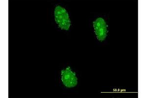 Immunofluorescence of monoclonal antibody to UHRF2 on HeLa cell. (UHRF2 抗体  (AA 81-180))