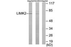 Western blot analysis of extracts from HepG2/HuvEc cells, using LIMK2 Antibody. (LIMK2 抗体  (AA 461-510))