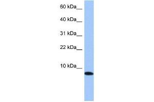 TNP1 antibody used at 1 ug/ml to detect target protein. (TNP1 抗体)