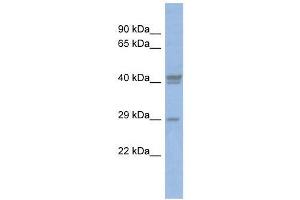 CEBPD antibody used at 0. (CEBPD 抗体  (Middle Region))