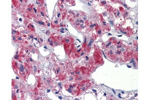 Immunohistochemistry (IHC) image for anti-T-Cell Acute Lymphocytic Leukemia 1 (TAL1) (C-Term) antibody (ABIN2792541)