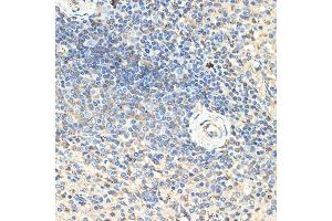 Immunohistochemistry of paraffin-embedded human spleen using CD70 Rabbit pAb (ABIN3022742, ABIN3022743, ABIN3022744, ABIN1512720 and ABIN6219205) at dilution of 1:100 (40x lens). (CD70 抗体  (AA 39-193))