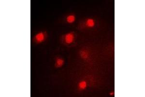 Immunofluorescent analysis of PAX3 staining in Hela cells. (Paired Box 3 抗体)