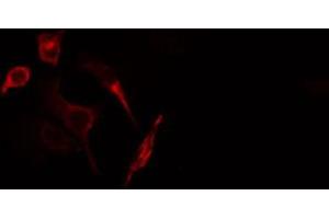 ABIN6266907 staining HuvEc cells by IF/ICC. (GUCY1B3 抗体  (N-Term))