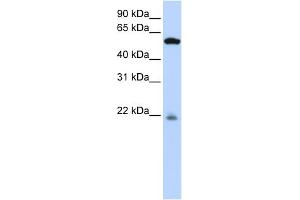WB Suggested Anti-PM20D2 Antibody Titration: 0. (PM20D2 抗体  (Middle Region))
