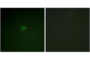 Immunofluorescence analysis of A549 cells, using 4E-BP1 (Ab-36) Antibody. (eIF4EBP1 抗体  (AA 2-51))