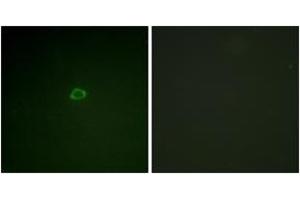 Immunofluorescence analysis of A549 cells, using 4E-BP1 (Ab-36) Antibody. (eIF4EBP1 抗体  (AA 2-51))