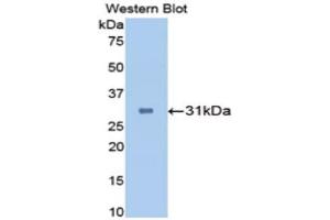 Western Blotting (WB) image for anti-Carbonic Anhydrase II (CA2) (AA 1-260) antibody (ABIN1173596) (CA2 抗体  (AA 1-260))