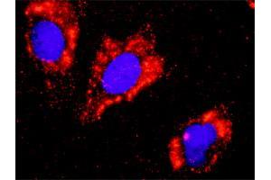 Proximity Ligation Analysis of protein-protein interactions between FLT1 and CTNNB1. (FLT1 抗体  (AA 1-687))