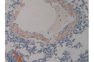 Detection of CLU in Mouse Lung Tissue using Polyclonal Antibody to Clusterin (CLU) (Clusterin 抗体  (AA 227-448))
