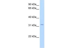 Western Blotting (WB) image for anti-Hydroxysteroid (17-Beta) Dehydrogenase 6 (HSD17B6) antibody (ABIN2462427) (HSD17B6 抗体)