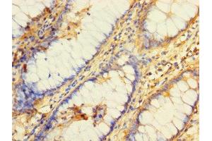 Immunohistochemistry (IHC) image for anti-BRCA1/BRCA2-Containing Complex, Subunit 3 (BRCC3) (AA 14-316) antibody (ABIN7158679)