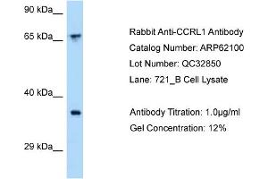 Western Blotting (WB) image for anti-Chemokine (C-C Motif) Receptor-Like 1 (CCRL1) (C-Term) antibody (ABIN2789017)