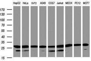 Image no. 3 for anti-Proteasome Subunit alpha 2 (PSMA2) (AA 50-234) antibody (ABIN1491567) (PSMA2 抗体  (AA 50-234))