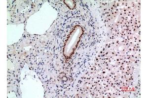Immunohistochemistry (IHC) analysis of paraffin-embedded Human Liver, antibody was diluted at 1:100. (BCL6 抗体  (Internal Region))