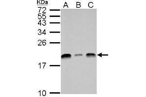 WB Image UBE2L3 antibody detects UBE2L3 protein by Western blot analysis. (UBE2L3 抗体  (C-Term))