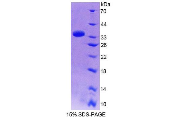 PPFIA1 Protein (AA 1-250) (T7 tag,His tag)