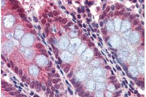 Human Colon: Formalin-Fixed, Paraffin-Embedded (FFPE) (BACE2 抗体  (AA 44-59))