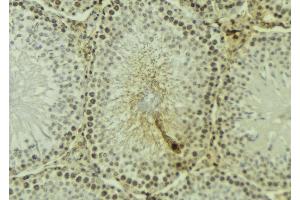 ABIN6277188 at 1/100 staining Mouse testis tissue by IHC-P. (UHRF1 抗体  (N-Term))