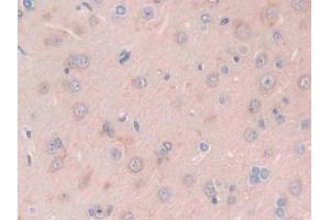 Immunohistochemistry (IHC) image for anti-phosphofructokinase, Platelet (PFKP) (AA 354-570) antibody (ABIN7443782)