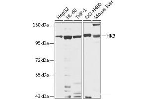 Western blot analysis of extracts of various cell lines using HK3 Polyclonal Antibody at dilution of 1:1000. (HK3 抗体)