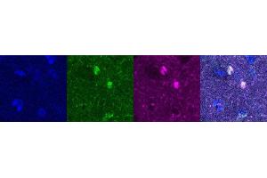 Immunohistochemistry (IHC) image for anti-Oligodendrocyte Lineage Transcription Factor 2 (OLIG2) antibody (ABIN7456250) (OLIG2 抗体)