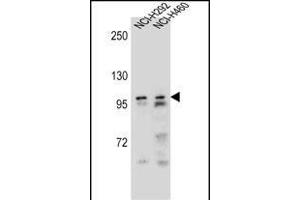 AR Antibody (Center) (ABIN656982 and ABIN2846165) western blot analysis in NCI-,NCI- cell line lysates (35 μg/lane). (Androgen Receptor 抗体  (Center))