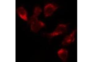 ABIN6277698 staining Hela by IF/ICC. (MSH3 抗体  (N-Term))