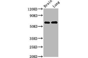 Western Blot Positive WB detected in: Rat brain tissue, Rat lung tissue All lanes: SELENON antibody at 4. (Selenoprotein N 抗体  (AA 135-219))