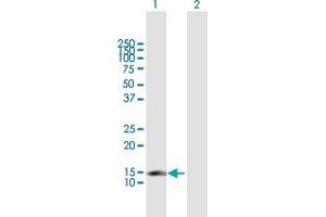 Western Blot analysis of CDKN2C expression in transfected 293T cell line by CDKN2C MaxPab polyclonal antibody. (CDKN2C 抗体  (AA 1-168))