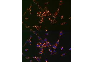 Immunofluorescence analysis of NIH-3T3 cells using ASL Rabbit pAb (ABIN6127448, ABIN6137201, ABIN6137202 and ABIN6221972) at dilution of 1:100 (40x lens). (ASL 抗体  (AA 1-300))