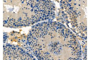 ABIN6257551 and ABIN6275682 at 1/100 staining Mouse testis tissue by IHC-P. (WASF2 抗体  (Internal Region))