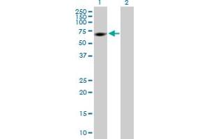 Western Blotting (WB) image for anti-Membrane Protein, Palmitoylated 2 (MAGUK P55 Subfamily Member 2) (MPP2) (AA 1-552) antibody (ABIN518002)