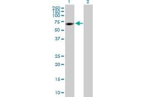 Western Blot analysis of MPP2 expression in transfected 293T cell line by MPP2 MaxPab polyclonal antibody. (MPP2 抗体  (AA 1-552))