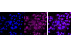 anti-Apurinic/Apyrimidinic Endonuclease 1 (APEX1) antibody