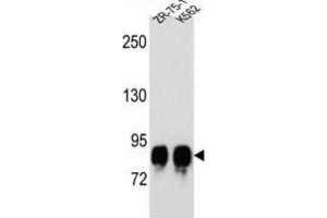 Western Blotting (WB) image for anti-Protein-O-Mannosyltransferase 1 (POMT1) antibody (ABIN2996702) (POMT1 抗体)