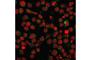 Immunofluorescence staining of U937 cells using CD15 Rabbit Recombinant Monoclonal Antibody (FUT4/1478R) followed by goat anti-Mouse IgG conjugated to CF488 (green). (Recombinant CD15 抗体)