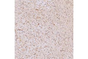 IHC analysis of SGCE using anti-SGCE antibody (ABIN7601544). (SGCE 抗体  (AA 38-407))