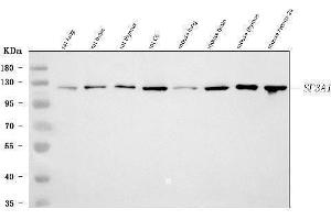 Western blot analysis of SF3A1 using anti-SF3A1 antibody (ABIN7600556). (SF3A1 抗体  (AA 20-556))