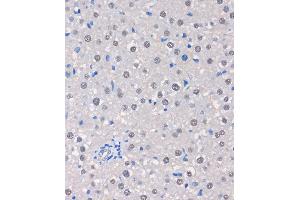 Immunohistochemistry of paraffin-embedded Rat liver using MTMR8 Rabbit pAb (ABIN7268766) at dilution of 1:100 (40x lens). (MTMR8 抗体  (AA 430-560))