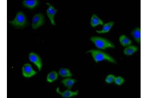 Immunofluorescence staining of A549 cells with ABIN7160322 at 1:133, counter-stained with DAPI. (ABCC6 抗体  (AA 730-931))