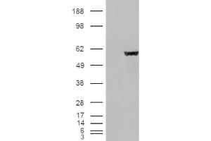 Western Blotting (WB) image for anti-Fumarate Hydratase (FH) (Internal Region) antibody (ABIN2465736) (FH 抗体  (Internal Region))