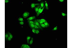 Immunofluorescence staining of HepG2 cells with ABIN7166863 at 1:100, counter-stained with DAPI. (PYGO2 抗体  (AA 175-325))