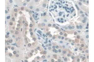 Detection of KATNA1 in Mouse Kidney Tissue using Polyclonal Antibody to Katanin P60 Subunit A 1 (KATNA1) (KATNA1 抗体  (AA 260-491))